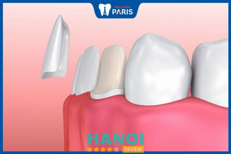 Nha Khoa Paris, Hà Nội