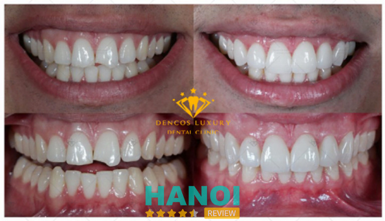 Nha khoa Dencos Luxury, Hà Nội