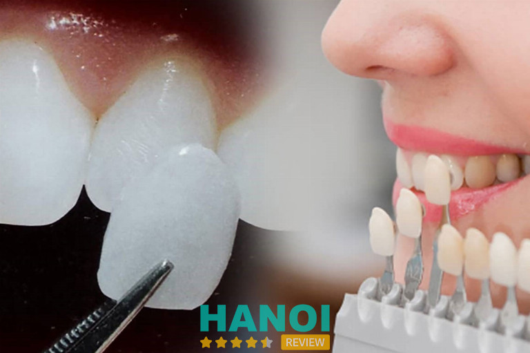 Nha khoa Quốc tế Việt Mỹ, Hà Nội