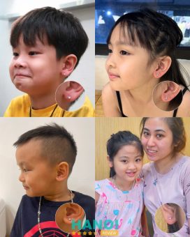 bấm lỗ tai cho bé hà nội