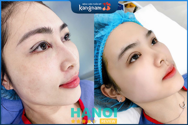 Bệnh viện thẩm mỹ Kangnam, Hà Nội 