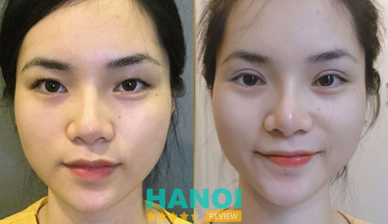 Thẩm mỹ viện VietCharm, Hà Nội 