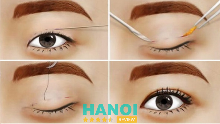 Viện thẩm mỹ Hà Nội, Hà Nội 