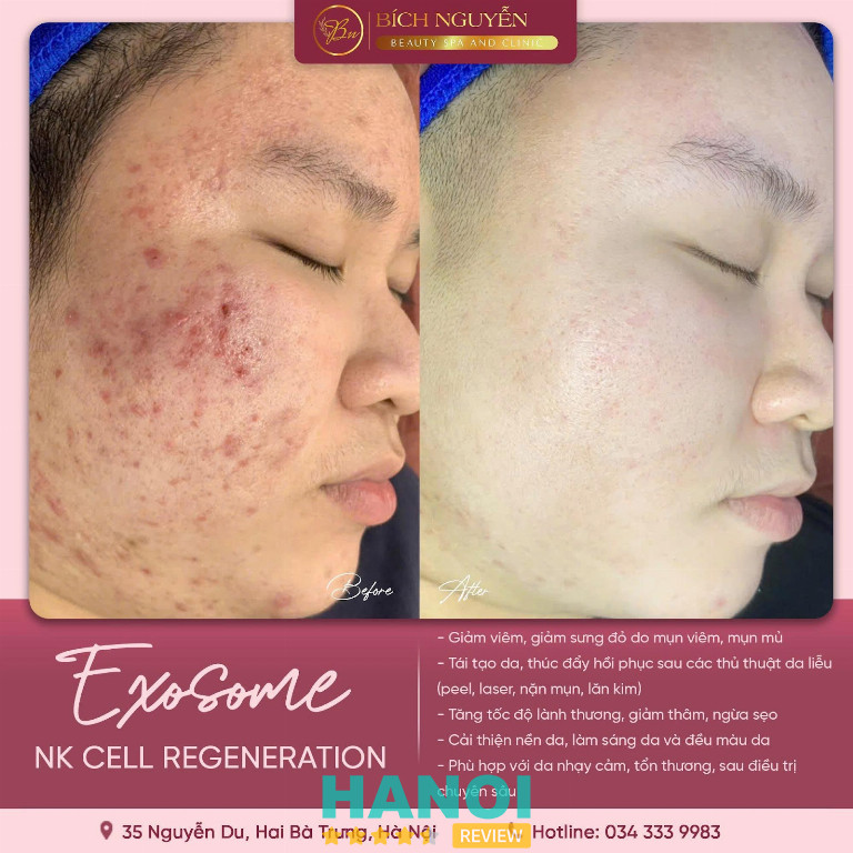 Bích Nguyễn Beauty Spa And Clinic Hà Nội Bích Nguyễn Beauty Spa And Clinic Hà Nội