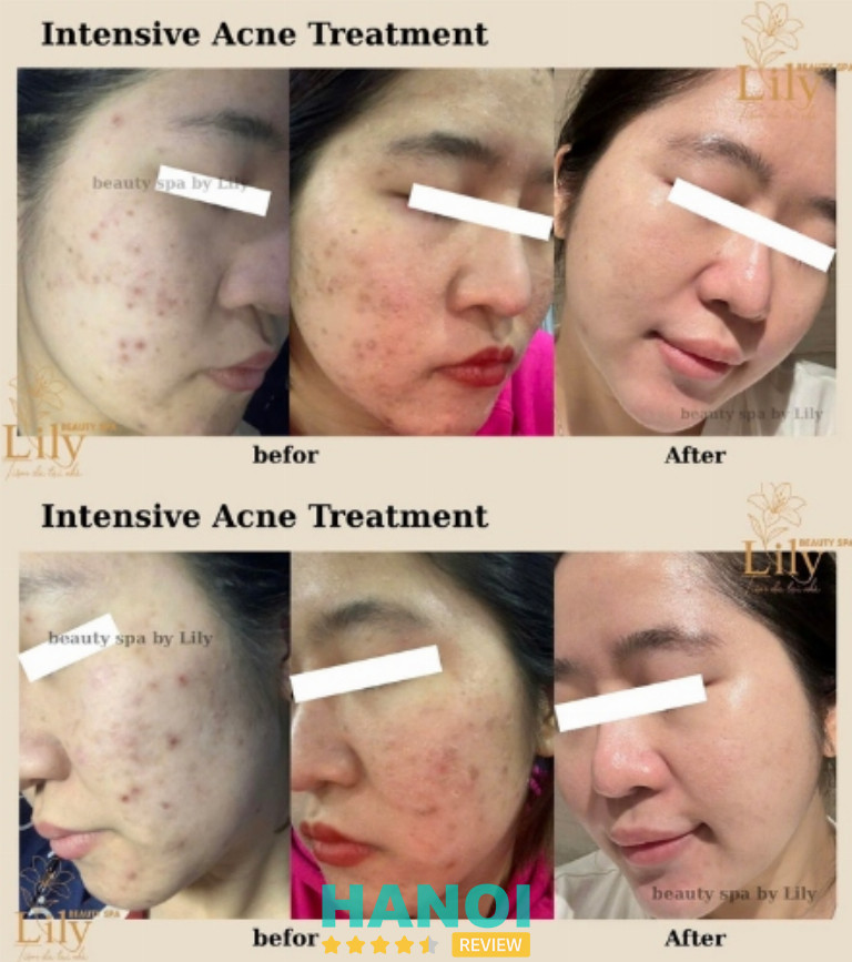 Tiệm DA Tại Nhà - Lily Beauty ở Hà Nội Tiệm DA Tại Nhà - Lily Beauty ở Hà Nội