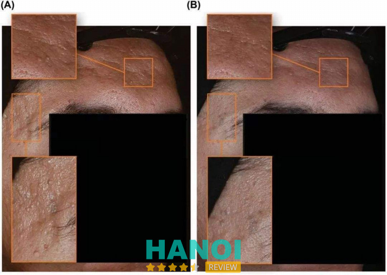 Bệnh viện Da liễu Hà Nội - P. Văn Miếu Quốc Tử Giám