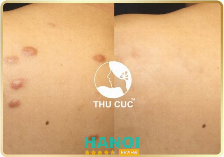 Bệnh viện Thẩm mỹ Thu Cúc - Hoàn Kiếm 