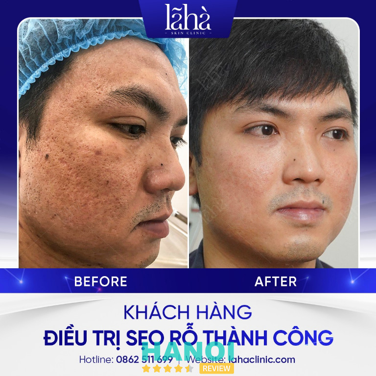 Lã Hà Clinic - Cầu Giấy