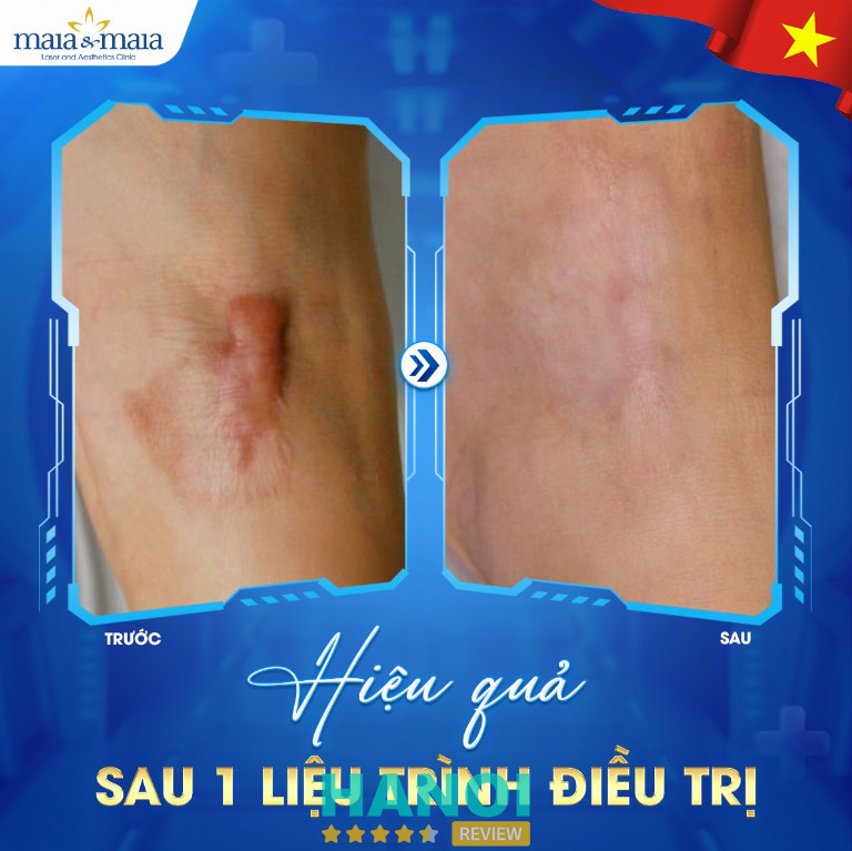 Phòng Khám Da Liễu Maia - Đống Đa 