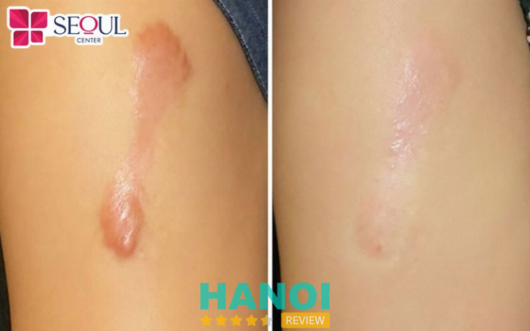 Seoul Center - Đống Đa 