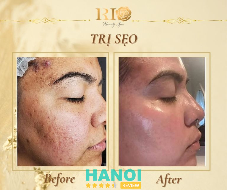 Thẩm mỹ Rio - Tây Hồ 