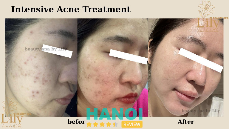 Tiệm DA Tại Nhà - Lily Beauty tại Hà Nội Tiệm DA Tại Nhà - Lily Beauty tại Hà Nội