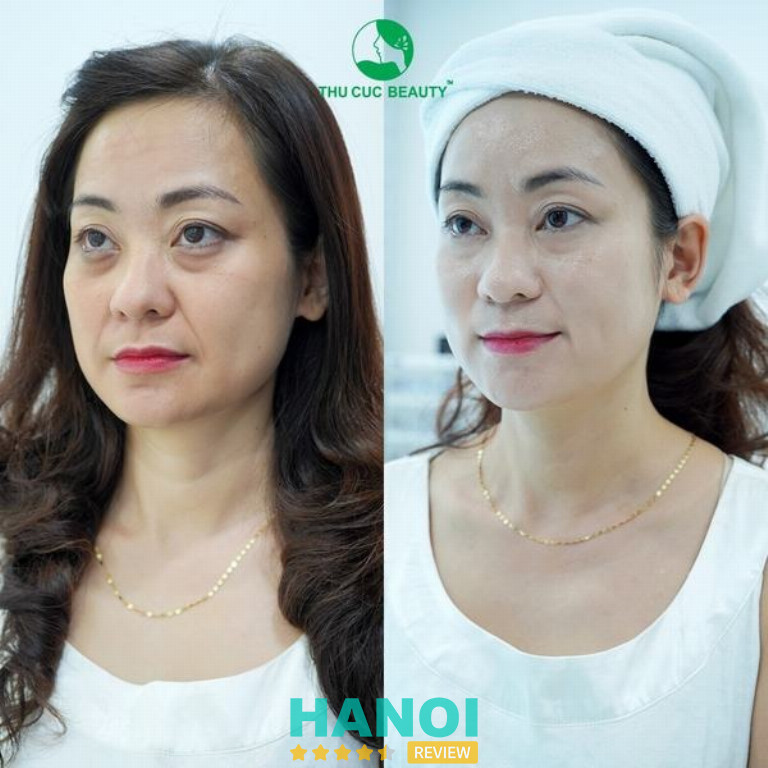 Bệnh viện Thẩm Mỹ Thu Cúc - P. Cửa Nam