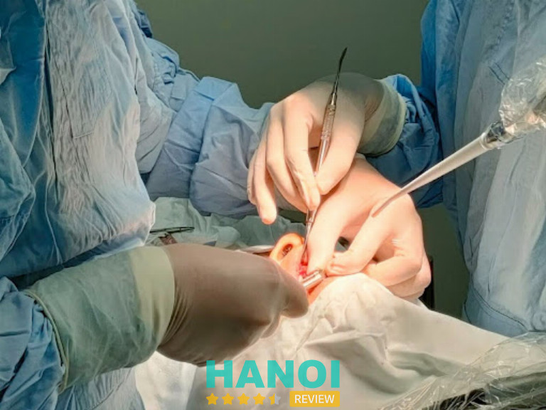 Giá Implant phụ thuộc số răng mất, loại trụ, tình trạng xương và phương án phục hình