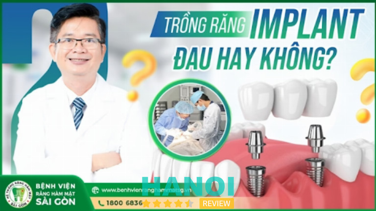 Bệnh Viện Răng Hàm Mặt Sài Gòn ứng dụng CT Cone Beam 3D và X-Guide hỗ trợ cấy ghép Implant an toàn, ít đau